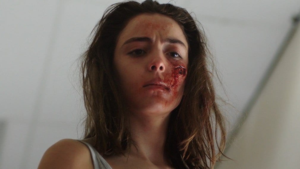 Justine stands, with a bloody wound on her cheek 