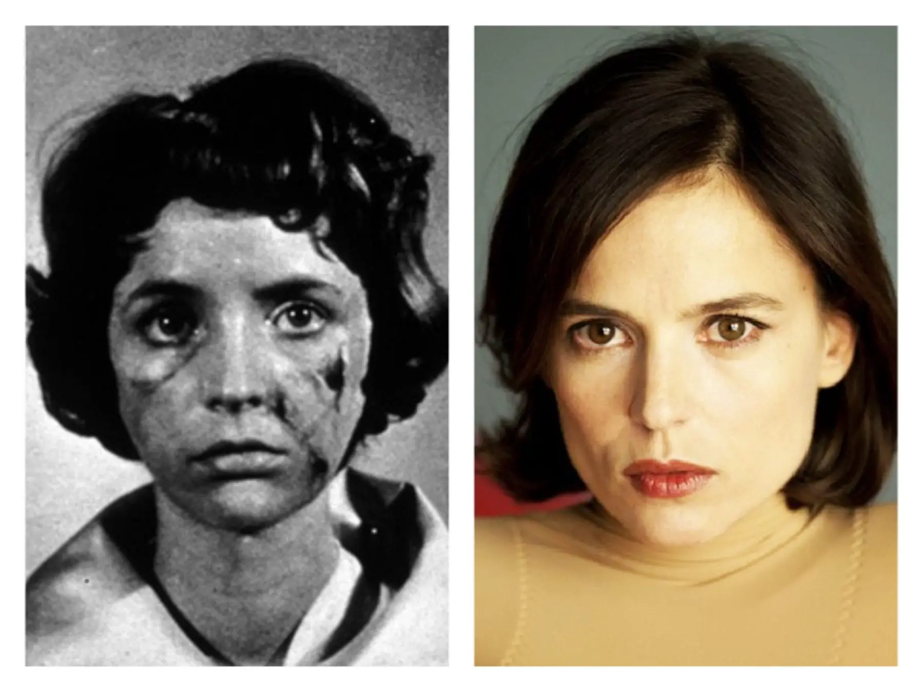 Juxtaposition of Christiane in Eyes Without a Face and Vera in The Skin I Live in.