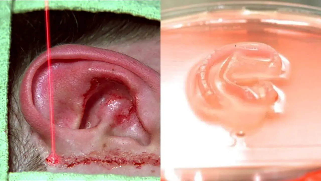 An image of an ear transplant from Face/Off next to one of an ear grown in a Petri dish